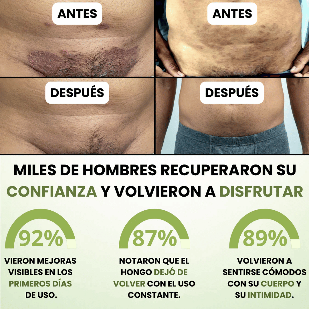 DermaForte: Fórmula clínica intensiva para erradicar hongos y aliviar la picazón severa