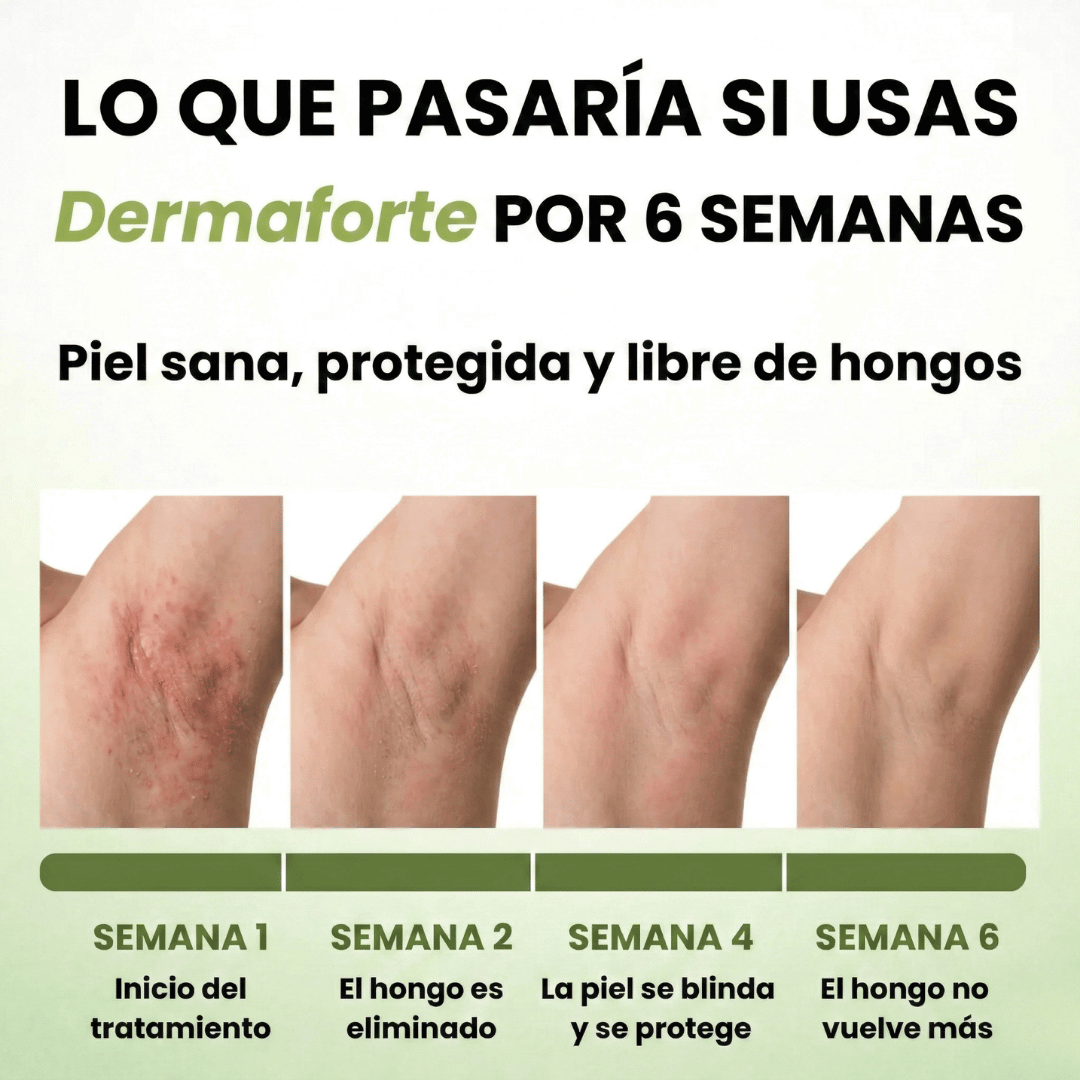 DermaForte: Fórmula clínica intensiva para erradicar hongos y aliviar la picazón severa