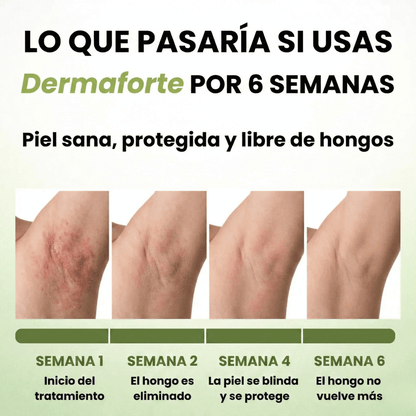 DermaForte: Fórmula clínica intensiva para erradicar hongos y aliviar la picazón severa